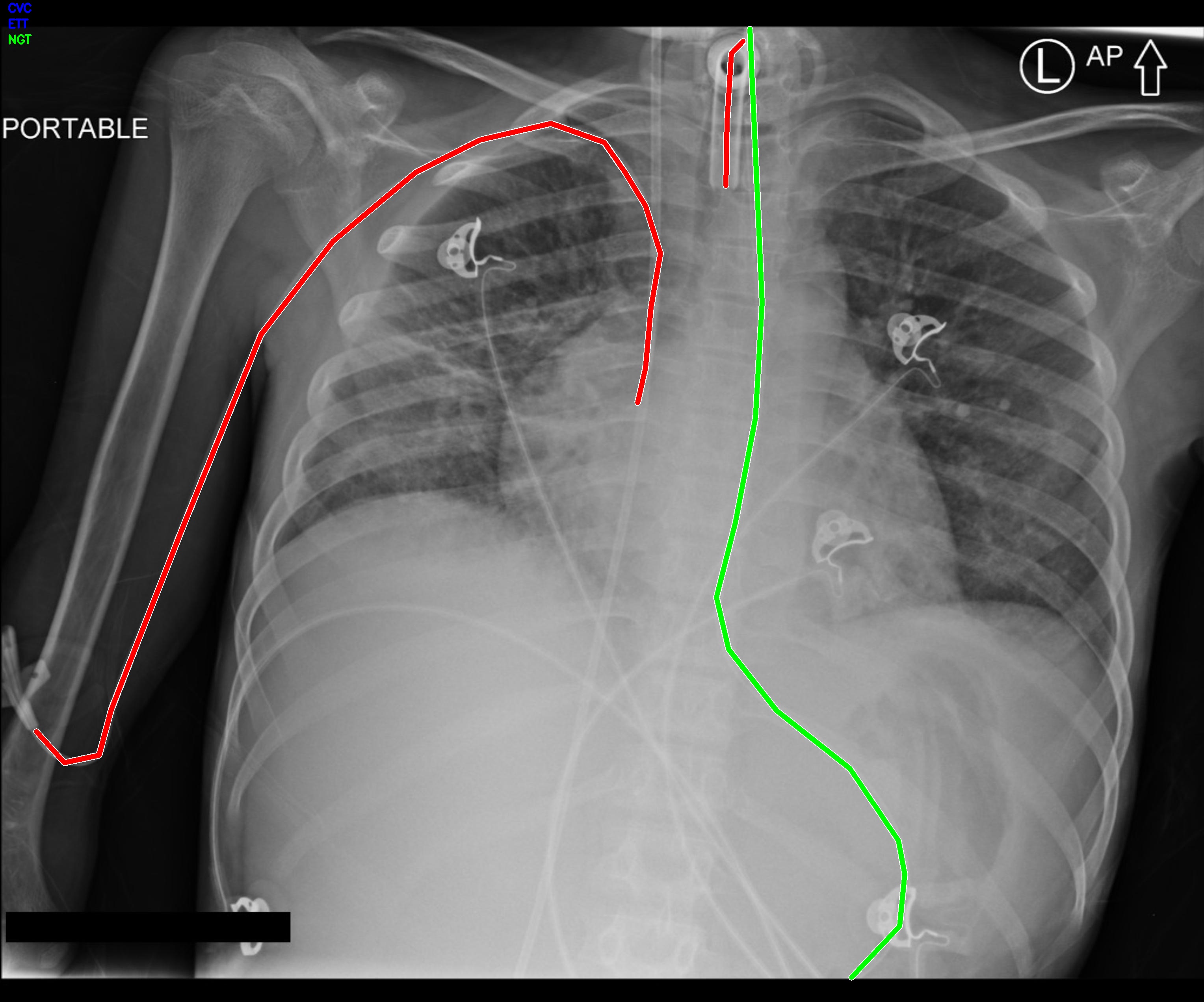 Medical Image Segmentation Example